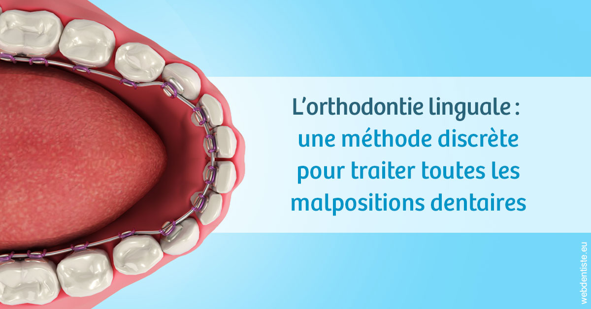 https://dr-poty-luc.chirurgiens-dentistes.fr/L'orthodontie linguale 1