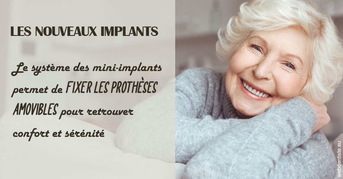https://dr-poty-luc.chirurgiens-dentistes.fr/Les nouveaux implants 1