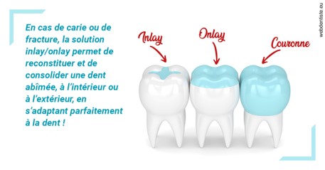 https://dr-poty-luc.chirurgiens-dentistes.fr/L'INLAY ou l'ONLAY