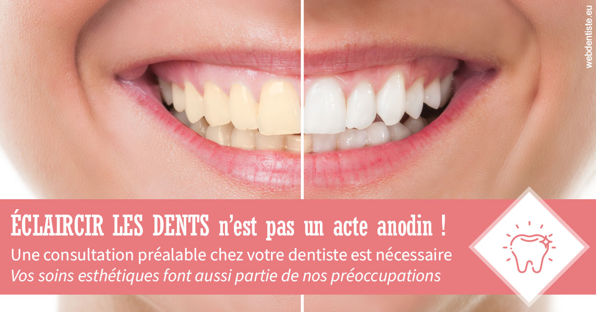 https://dr-poty-luc.chirurgiens-dentistes.fr/Eclaircir les dents 1