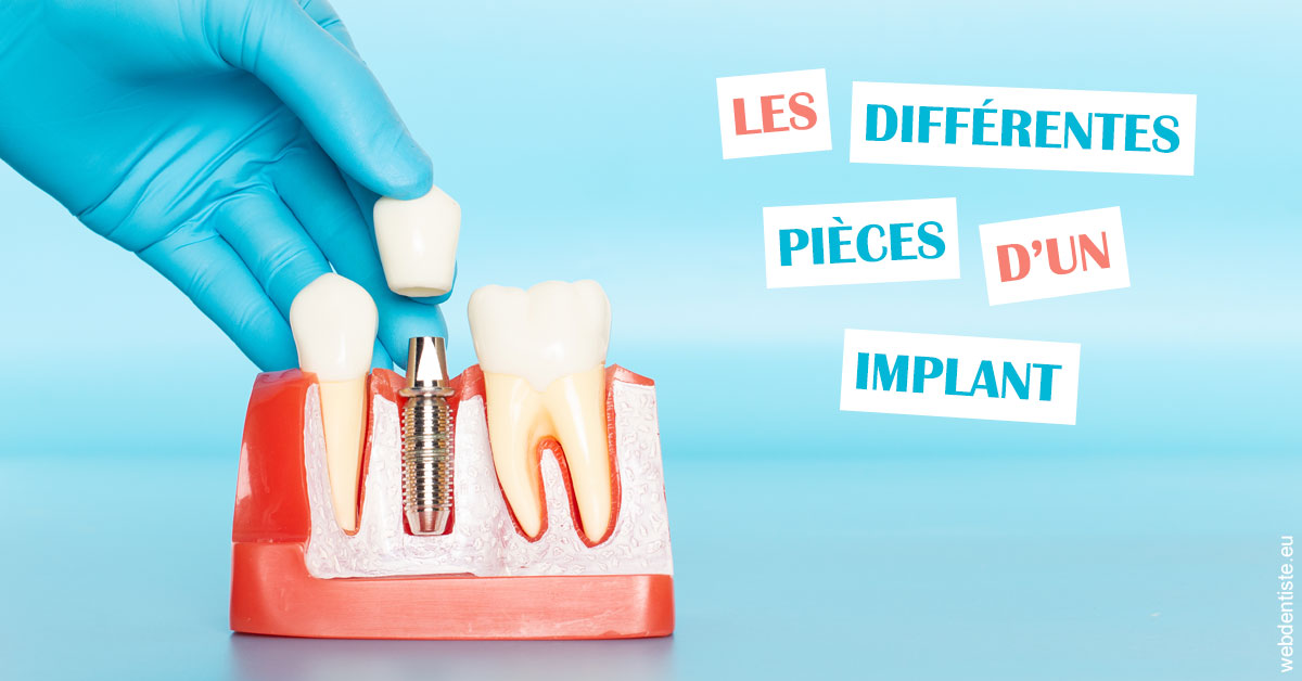 https://dr-poty-luc.chirurgiens-dentistes.fr/Les différentes pièces d’un implant 2