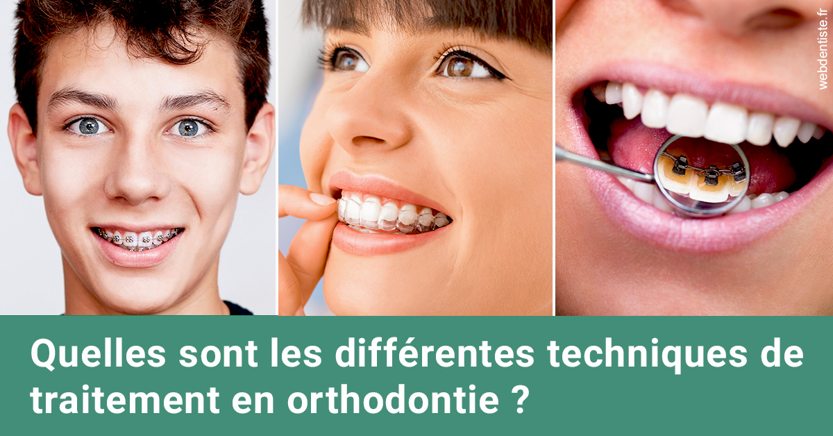 https://dr-poty-luc.chirurgiens-dentistes.fr/Les différentes techniques de traitement 2