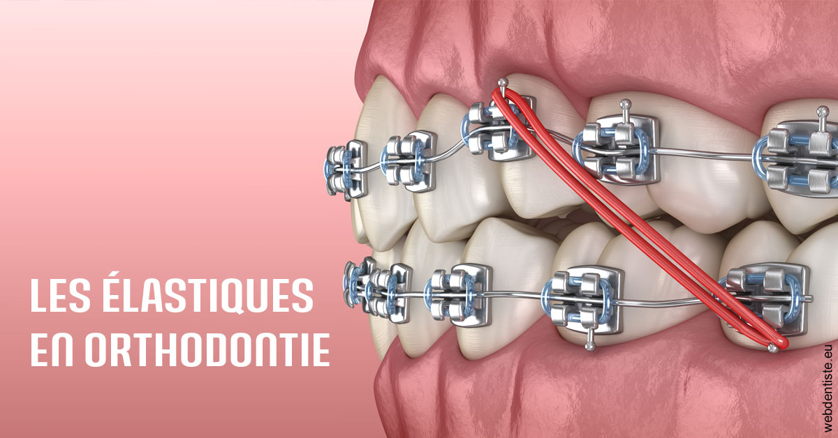 https://dr-poty-luc.chirurgiens-dentistes.fr/Elastiques orthodontie 2