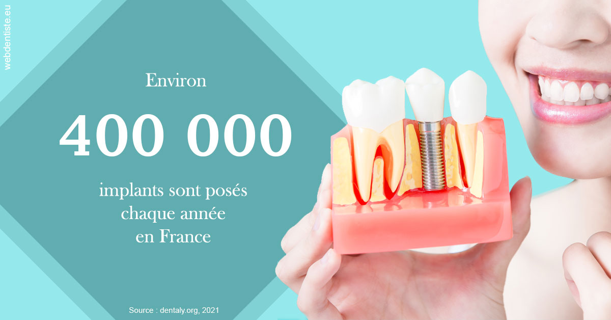 https://dr-poty-luc.chirurgiens-dentistes.fr/Pose d'implants en France 2